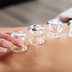 Cupping Therapy